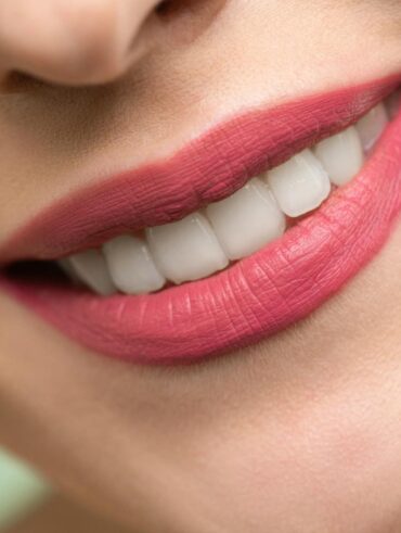 Vivid close-up image of a woman's smile showcasing red lipstick and white teeth on a light background.