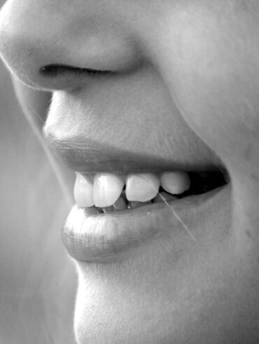 A monochrome close-up of a smiling face showcasing teeth and lips.