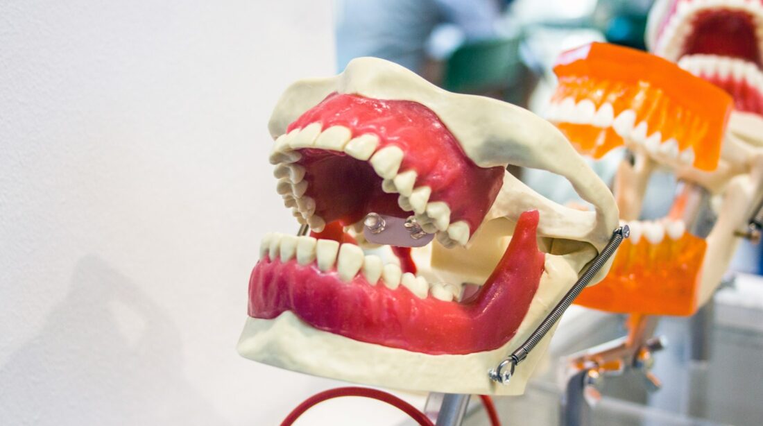a close up of a fake mouth with teeth