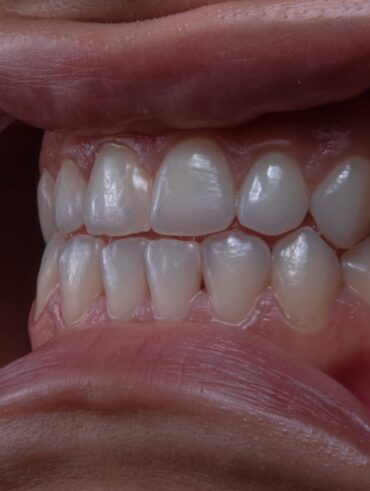 a close up of a bowl