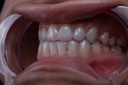 a close up of a bowl