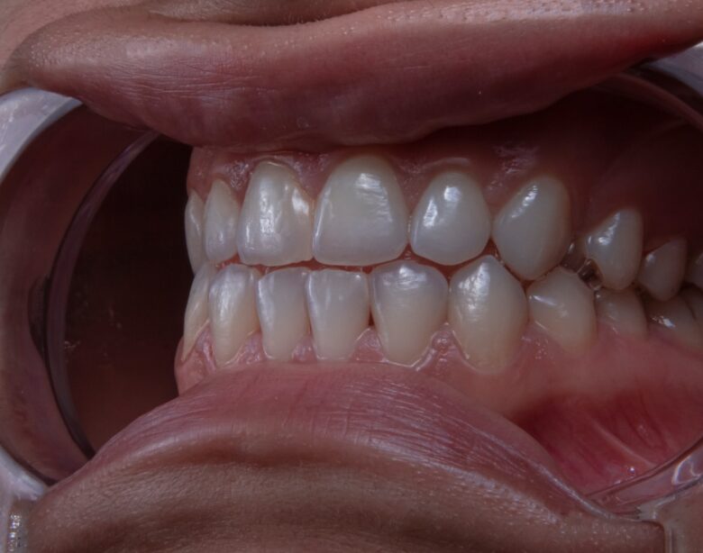 a close up of a bowl